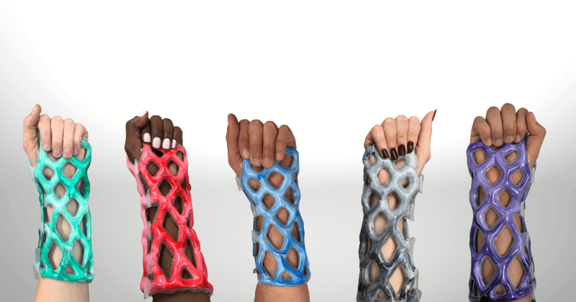 Cast21: Revolutionizing Orthopedic Care for the Modern Era