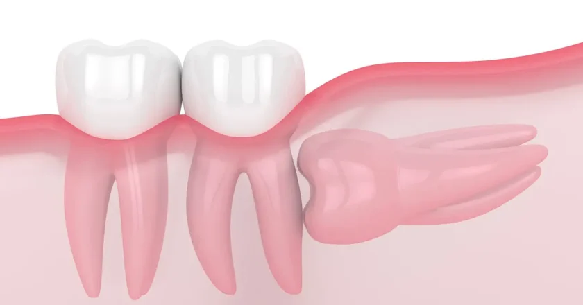 Humans Are Still Evolving: The Mystery of Shrinking Jaws and Disappearing Teeth