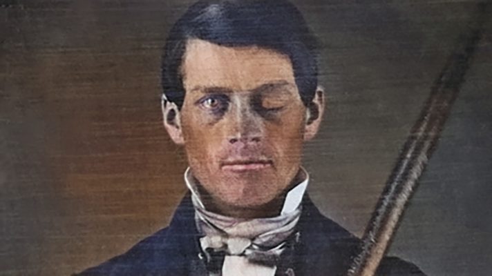 Phineas Gage: The Man Who Revolutionized Our Understanding of the Brain