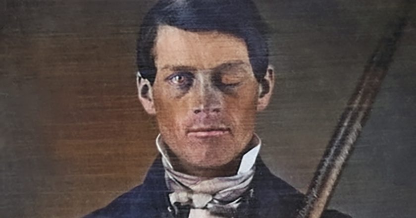 Phineas Gage: The Man Who Revolutionized Our Understanding of the Brain